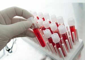 Какие разновидности анализов крови существуют?